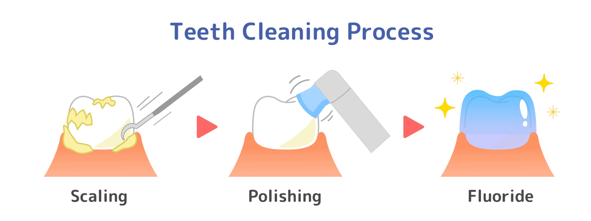 Dental Hygienist Cleaning Teeth | What Do Dental Hygienists Clean Teeth With?