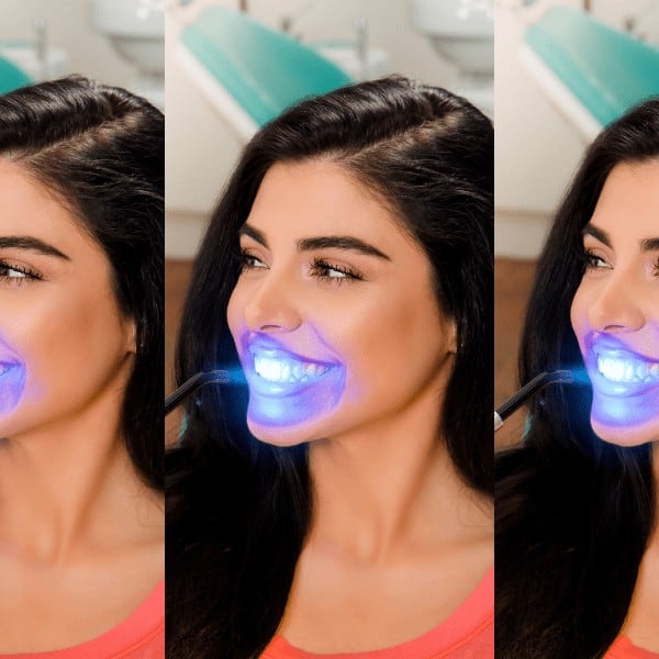 7 Genious Whitening Secrets! | How To Get White Teeth In Minutes!