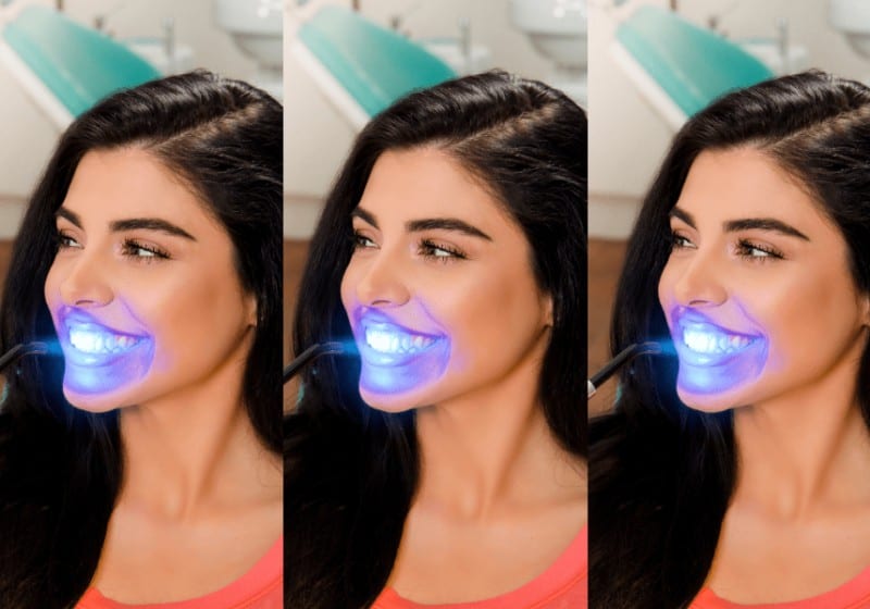 How To Get White Teeth In Minutes