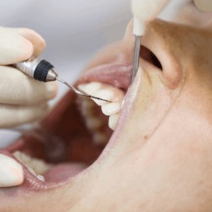 how to become a dental hygienist