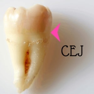 periodontal prophylaxis